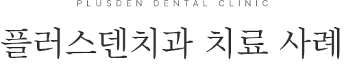 플러스덴치과 치료 사례